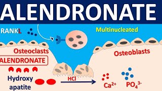 Alendronate for osteoporosis  Mechanism side effects precautions amp uses [upl. by Berneta]