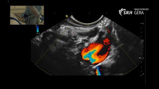 The Role and Anatomy of the Pancreas [upl. by Nilhsa]