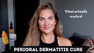 Perioral Dermatitis Treatment [upl. by Aldon]