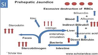 Prehepatic jaundice  الصفراء التحليلية [upl. by Nnahgiel]