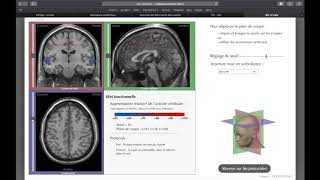 tutoriel IRM virtuelle [upl. by Namie]