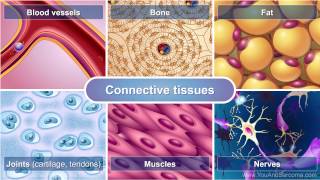 Understanding Soft Tissue Sarcoma [upl. by Anyrtak]