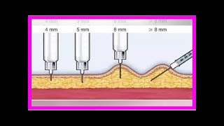 為什麼皮下注射胰島素時要捏起皮膚？ [upl. by Maure]