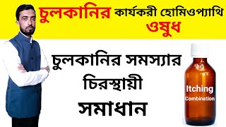 চুলকানির স্রষ্ঠ হোমিওপ্যাথি ওষুধ  Itching Homeopathy Medicines  Bangla [upl. by Uv]