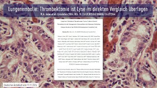 Lungenembolie Thrombektomie ist Lyse im direkten Vergleich überlegen [upl. by Nitniuq402]