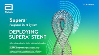 How to Deploy the Supera Stent  Supera Stent System Overview [upl. by Atteuqal]