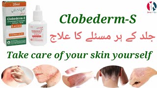 ClobedermS Lotion uses benefits in UrduHindi [upl. by Antonetta]