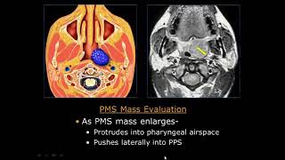 Approach to the suprahyoid neck Basic Radiology [upl. by Einiar]