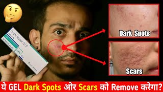 क्या Benzoyl Peroxide Gel Dark Spots ओर Scars को भी Remove करता है  Honest Review [upl. by Rosy]