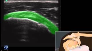 How To Shoulder Subscapularis Tendon 3D Video [upl. by Waring]