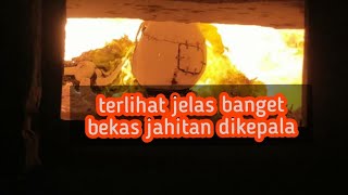 PROSES KREMASI  TERLIHAT JELAS BEKAS JAHITAN DIKEPALANYA [upl. by Wolfe229]