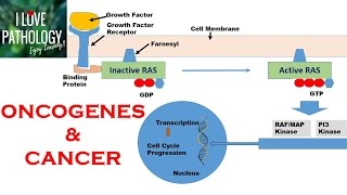 NEOPLASIA 2 HALLMARKS OF CANCER  Protooncogenes Oncogenes amp Oncoproteins [upl. by Nelaf203]