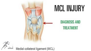 MCL tear of the knee Injury diagnosis treatment [upl. by Iney]