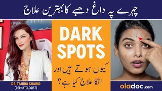 Chehre Ke Daag Dhabe Ka Ilaj  Dark Spots On Face Removal  Pigmentation Treatment  Spotless Skin [upl. by Filip]