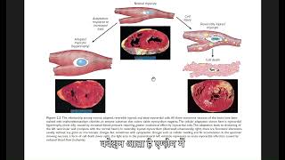 PATHO1 General Pathology Introduction [upl. by Sylvanus]