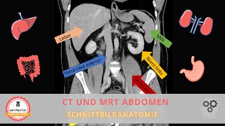 Schnittbildgebung des Abdomens Anatomie [upl. by Dearman]