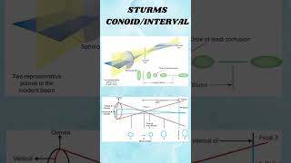 Astigmatism shortvideio viralshort ytshorts [upl. by Lerej]