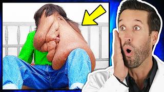 ER Doctor REACTS to Worlds Rarest Diseases [upl. by Franky]