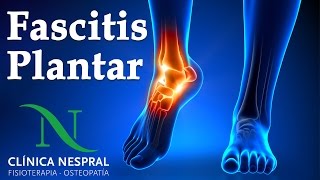 Fascitis Plantar Causas Síntomas y Tratamiento  Clínica Nespral  Fisioterapia y Osteopatía [upl. by Siuluj463]