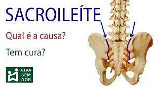 Sacroileíte  Qual é a causa Tem cura [upl. by Atilem831]