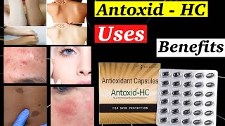 Antoxid hc capsules  antoxid hc capsules for skin  Antioxidant Capsules Benefits  Review Hindi [upl. by Eesac]