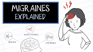 Migraines 101 Symptoms [upl. by Slen962]