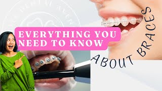 Everything you need to know about Braces [upl. by Ahsenek]