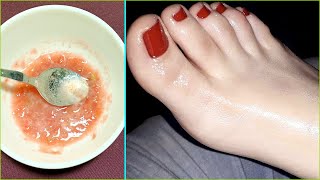 Hand And Feet Whitening Home Remedy Get Smooth Fair And Glowing Skin At Home [upl. by Kerat]