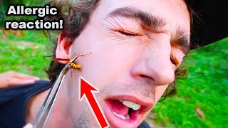 STUNG in FACE by an EXECUTIONER WASP Exposed Coyote Peterson [upl. by Almond]