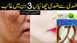 Hyperpigmentation herbal Treatment  Chaiyon Ka Ilaj  Glowing Skin Tips  Melasma Home Remedy [upl. by Rramal70]