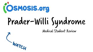 PraderWilli Syndrome Osmosis Study Video [upl. by Nadnal279]