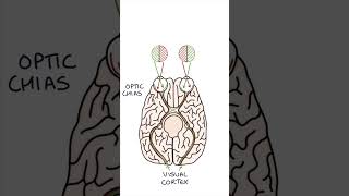 Bitemporal Hemianopia medicine clinicalexamination ophthalmology [upl. by Nylasor308]