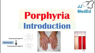 Introduction to Porphyria  Porphyria Cutanea Tarda vs Acute Intermittent Porphyria [upl. by Anauq489]