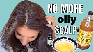 LIFE CHANGING DIY Hair mask for OILY HAIR  NO MORE OILY SCALP [upl. by Jac864]