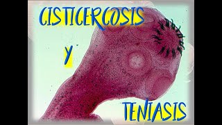 Taenia solium Cisticercosis y Teniasis [upl. by Assyle295]