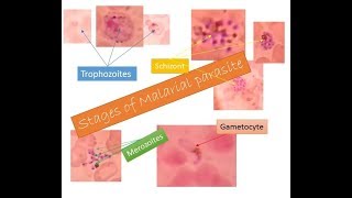 Malarial parasites identification within two minutes  Trophozoite Schizont Gametocyte Merozoite [upl. by Uda371]