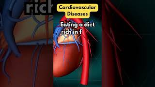 Cardiovascular Diseases [upl. by Nim]