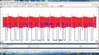 VAUXHALL CORSA CAM SHAFT SENSOR REPLACEMENT  VAUXHALL CORSA D  HOW TO CHANGE CAM SHAFT SENSOR [upl. by Einnal]