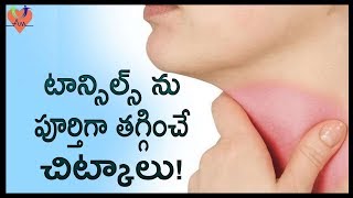 టాన్సిల్స్ ను పూర్తిగా తగ్గించే చిట్కాలు   Best Natural Home Remedies To Cure Tonsillitis  Arogya [upl. by Yorgerg723]