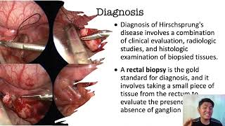 Understanding Hirschsprungs Disease for Midwifery and Nursing Students [upl. by Dnomse694]