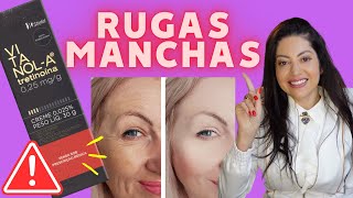 VitanolA Vitacid Tretinoína Clareia Manchas Reduz Rugas e Combate Acne Como Usar [upl. by Enirehtak]