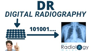 Direct vs Indirect Digital Radiography DR for Radiologic Technologists [upl. by Jowett]