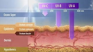 NonMelanoma Skin Cancer [upl. by Ossy]