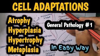 Cell Adaptations  HypertrophyHyperplasia Metaplasia and Atrophy  General Pathology 1 [upl. by Elohcan121]