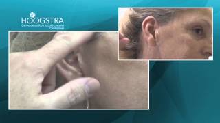 Lifting de cara y cuello  Cómo evitar las cicatrices 14043 [upl. by Kinney]