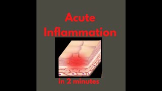 Acute inflammation in 2 mins [upl. by Carlynne]