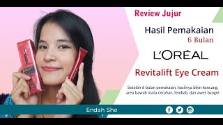 Review Hasil Pemakaian Revitalift Laser X3 Eye Cream Loreal Paris  Selama 6 Bulan [upl. by Yarb18]