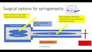 Surgical Interventions for Canine Chiari and Syringomyelia [upl. by Aneeled]