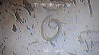 Trichinella spiralis [upl. by Ollehto]