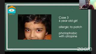 Amblyopia quotOLD DISEASE NEW REGIMENSquot by Dr Aditya Sethi [upl. by Suzanne]